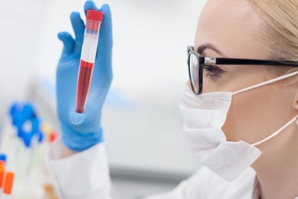 proba de sangue para hipertensión